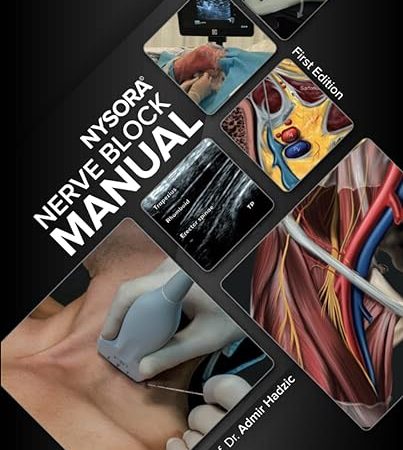 NYSORA Nerve Block Manual (Hadzic)