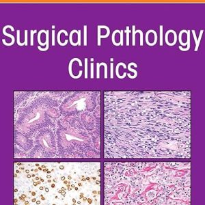 Pancreatobiliary Pathology, An Issue of Surgical Pathology Clinic)