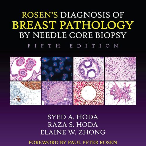 Rosen’s Diagnosis of Breast Pathology by Needle Core Biopsy 5thEdition