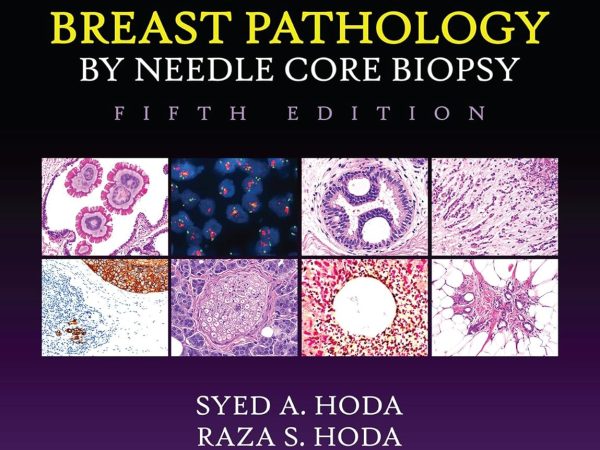 Rosen’s Diagnosis of Breast Pathology by Needle Core Biopsy 5th Edition