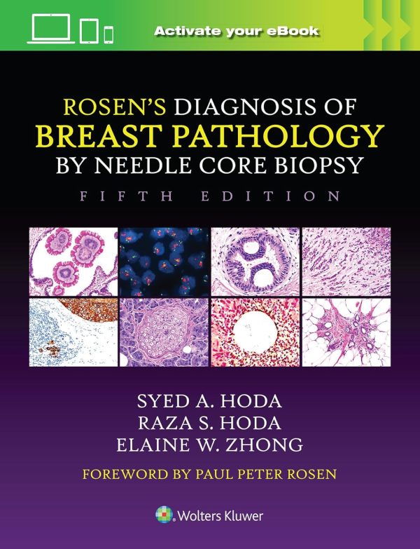 Rosen’s Diagnosis of Breast Pathology by Needle Core Biopsy 5th Edition
