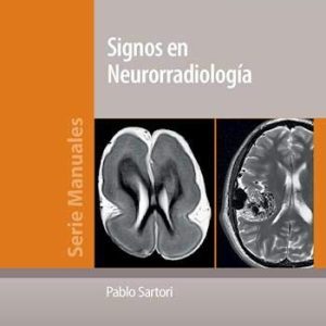 Signos en Neurorradiología