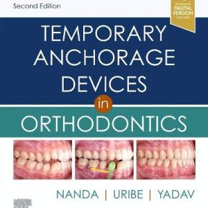 Temporary Anchorage Devices in Orthodontics 2nd Edition