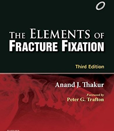 The Elements of Fracture Fixation 3rd  Edition