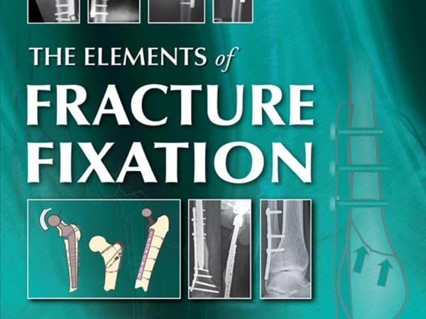 The Elements of Fracture Fixation 4th Edition