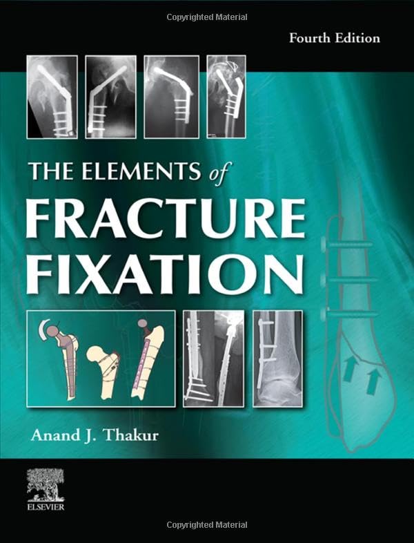 The Elements of Fracture Fixation 4th Edition