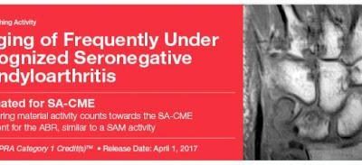 2017 imaging of frequently under recognized seronegative spondyloarthritis