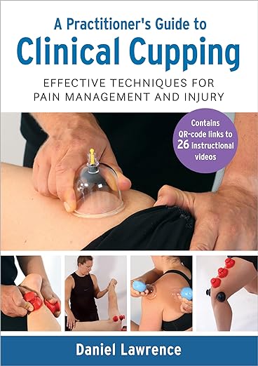 A Practitioner’s Guide to Clinical Cupping Effective Techniques for Pain Management and Injury