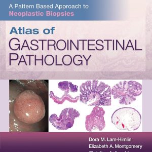 Atlas of Gastrointestinal Pathology: A Pattern Based Approach to Neoplastic Biopsies 1st Edition