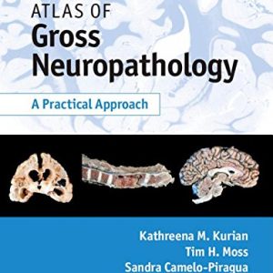 Atlas of Gross Neuropathology : A Practical Approach 1st Edition