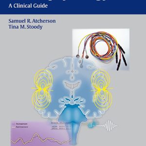 Auditory Electrophysiology: A Clinical Guide 1st Edition