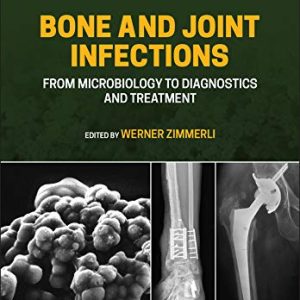 Bone and Joint Infections From Microbiology to Diagnostics and Treatment 2nd Edition