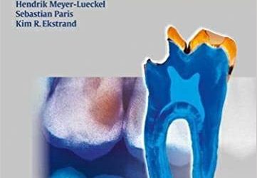 Caries Management – Science and Clinical Practice 1st Edition