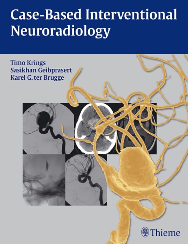 Case-Based Interventional Neuroradiology 1st Edition