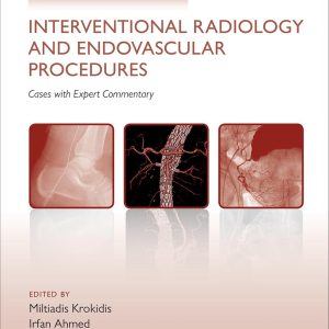 Challenging Concepts in Interventional Radiology 1st Edition