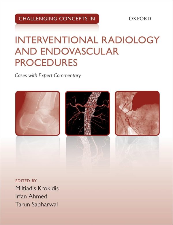 Challenging Concepts in Interventional Radiology 1st Edition