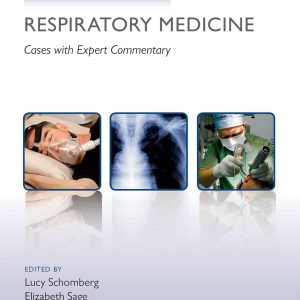 Challenging Concepts in Respiratory Medicine: Cases with Expert Commentary 1st Edition