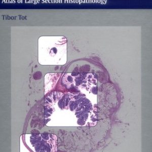 Colorectal Tumors Atlas of Large Section Histopathology 1st Edition