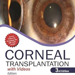 Corneal Transplantation 3rd Edition