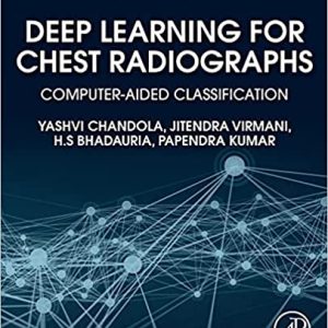 Deep Learning for Chest Radiographs Computer Aided Classification