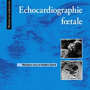 Echocardiographie fœtale (French Edition) 2022 Edition