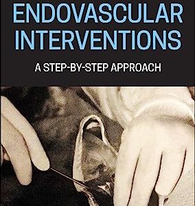 Endovascular Interventions: A Step-by-Step Approach