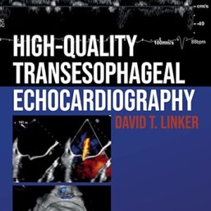 High-Quality Transesophageal Echocardiography 1st Edition