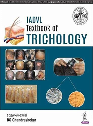 IADVL Textbook of Trichology 1st Edition