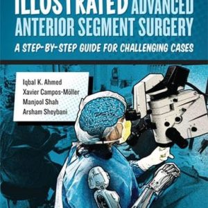 Illustrated Advanced Anterior Segment Surgery A Step-by-Step Guide for Challenging Cases 1st Edition