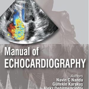 Manual of Echocardiography 2e 2nd Edition