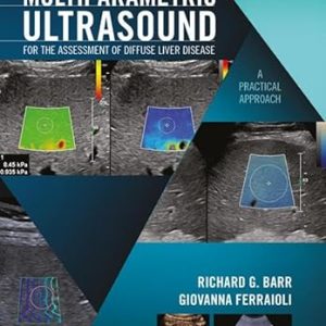 Multiparametric Ultrasound for the Assessment of Diffuse Liver Disease A Practical Approach 1st Edition