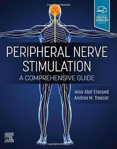 Peripheral Nerve Stimulation A Comprehensive Guide 1st Edition
