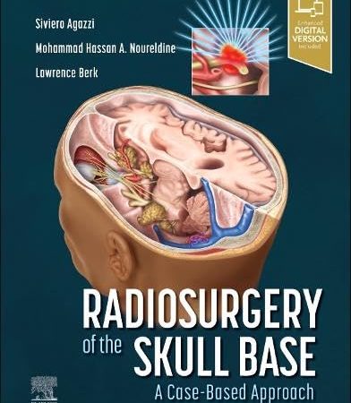 Radiosurgery of the Skull Base A Case-Based Approach 1st Edition