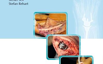 Surgery for Rheumatic Diseases Illustrated Edition