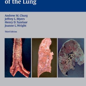 Thurlbeck’s Pathology of the Lung 3rd Edition
