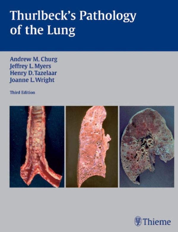 Thurlbeck’s Pathology of the Lung 3rd Edition