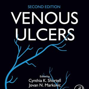 Venous Ulcers 2nd Edition, Second ed