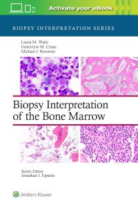 Biopsy Interpretation of the Bone Marrow (Biopsy Interpretation Series) 1st Edition