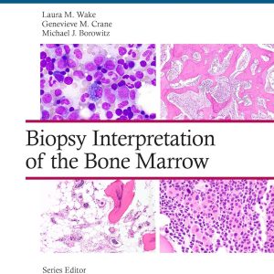 Biopsy Interpretation of the Bone Marrow (Biopsy Interpretation Series) 1st Edition
