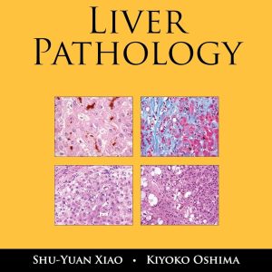 Liver Pathology (Demos Surgical Pathology Guides) 1st Edition