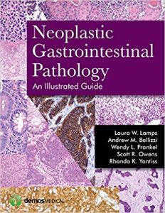Neoplastic Gastrointestinal Pathology: An Illustrated Guide 1st Edition