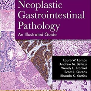 Neoplastic Gastrointestinal Pathology: An Illustrated Guide 1st Edition