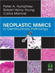 Neoplastic Mimics in Genitourinary Pathology (Pathology of Neoplastic Mimics) 1st Edition