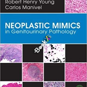 Neoplastic Mimics in Genitourinary Pathology (Pathology of Neoplastic Mimics) 1st Edition