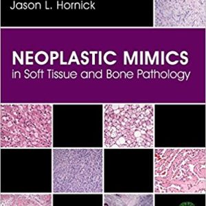 Neoplastic Mimics in Soft Tissue and Bone Pathology (Pathology of Neoplastic Mimics) 1st Edition