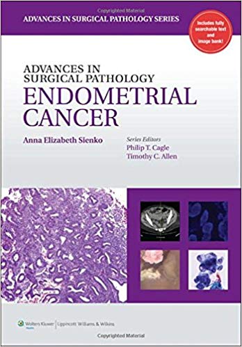 Advances In Surgical Pathology Endometrial Cancer