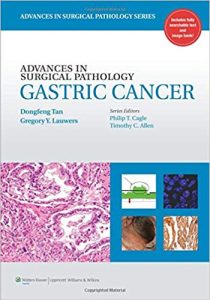 Advances in Surgical Pathology – Gastric Cancer