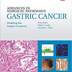 Advances in Surgical Pathology – Gastric Cancer