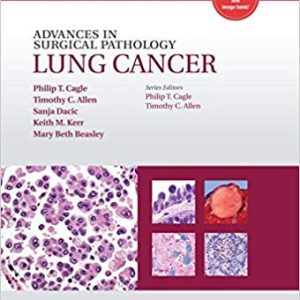 Advances in Surgical Pathology: Lung Cancer 1st Edition