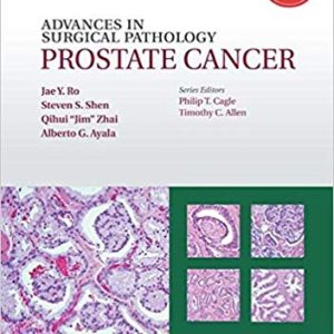 Advances in Surical Pathology Prostate Cancer (Advances in Surgical Pathology) 1st Edition